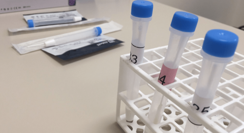 Imagen de archivo de unas pruebas de diagnóstico / TA